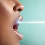 ЛАЗЕРНОЕ ОТБЕЛИВАНИЕ ЗУБОВ