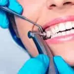 ПОЛНАЯ ЧИСТКА ЗУБОВ